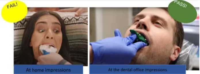 Ceramic Braces